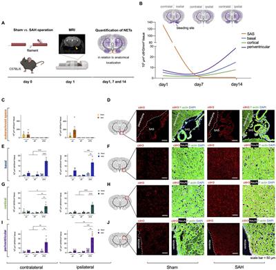 RNase A Inhibits Formation of Neutrophil Extracellular Traps in Subarachnoid Hemorrhage